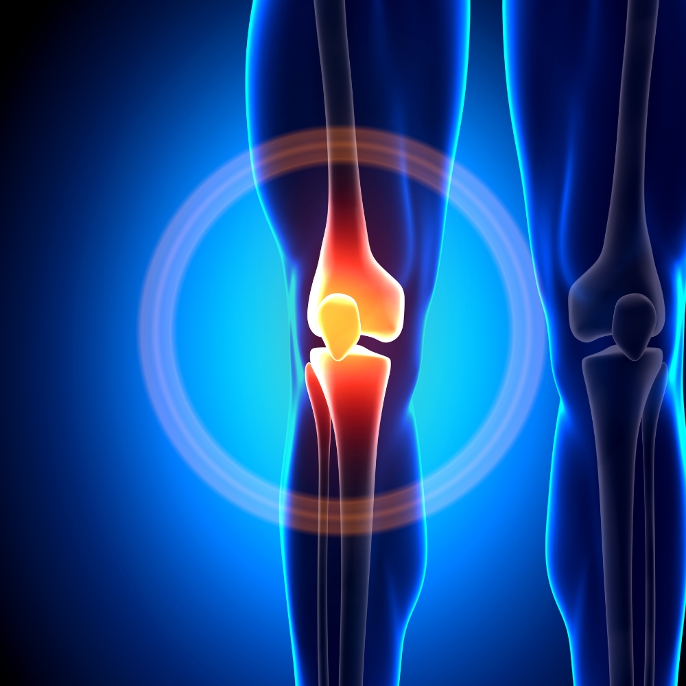 Gelenkersatz am Knie
