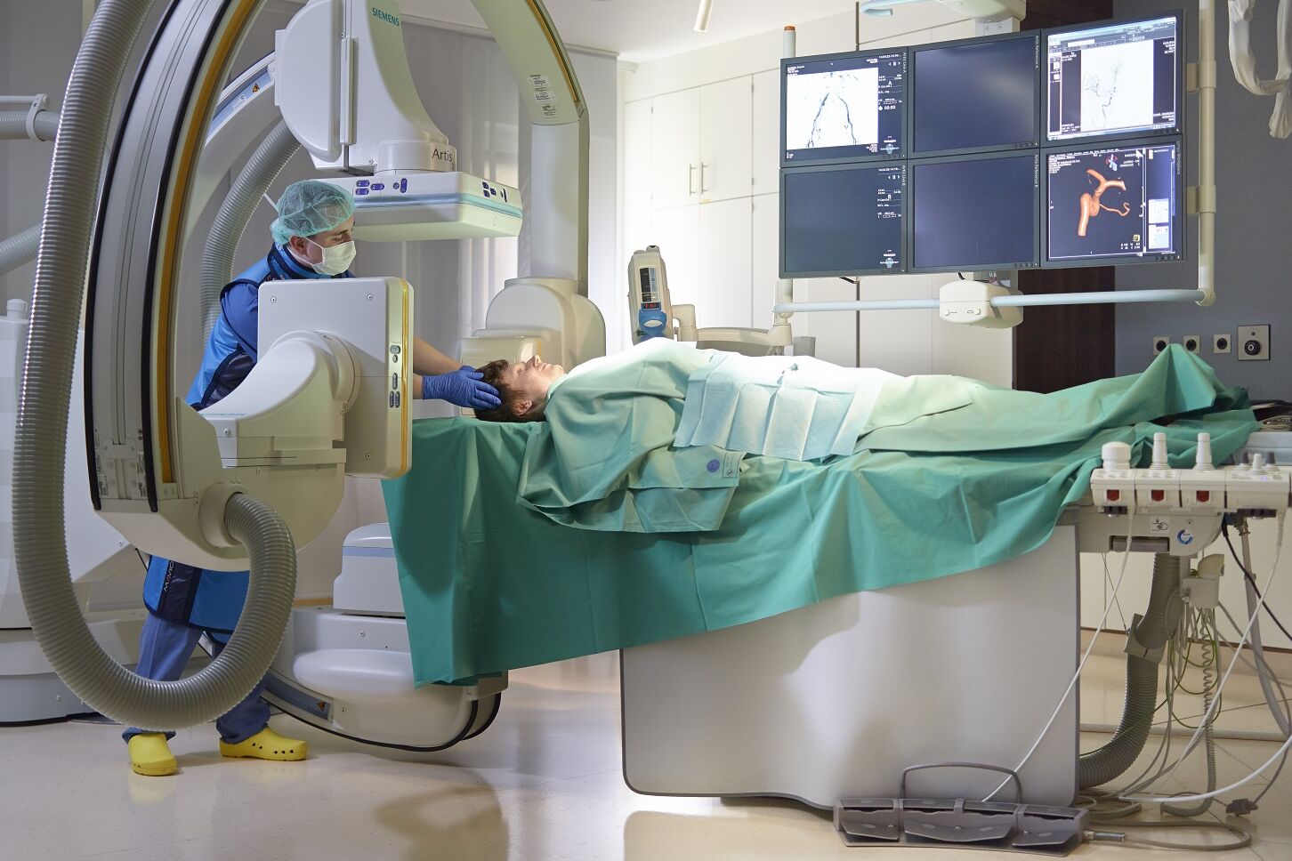 Angiographie Angiographie