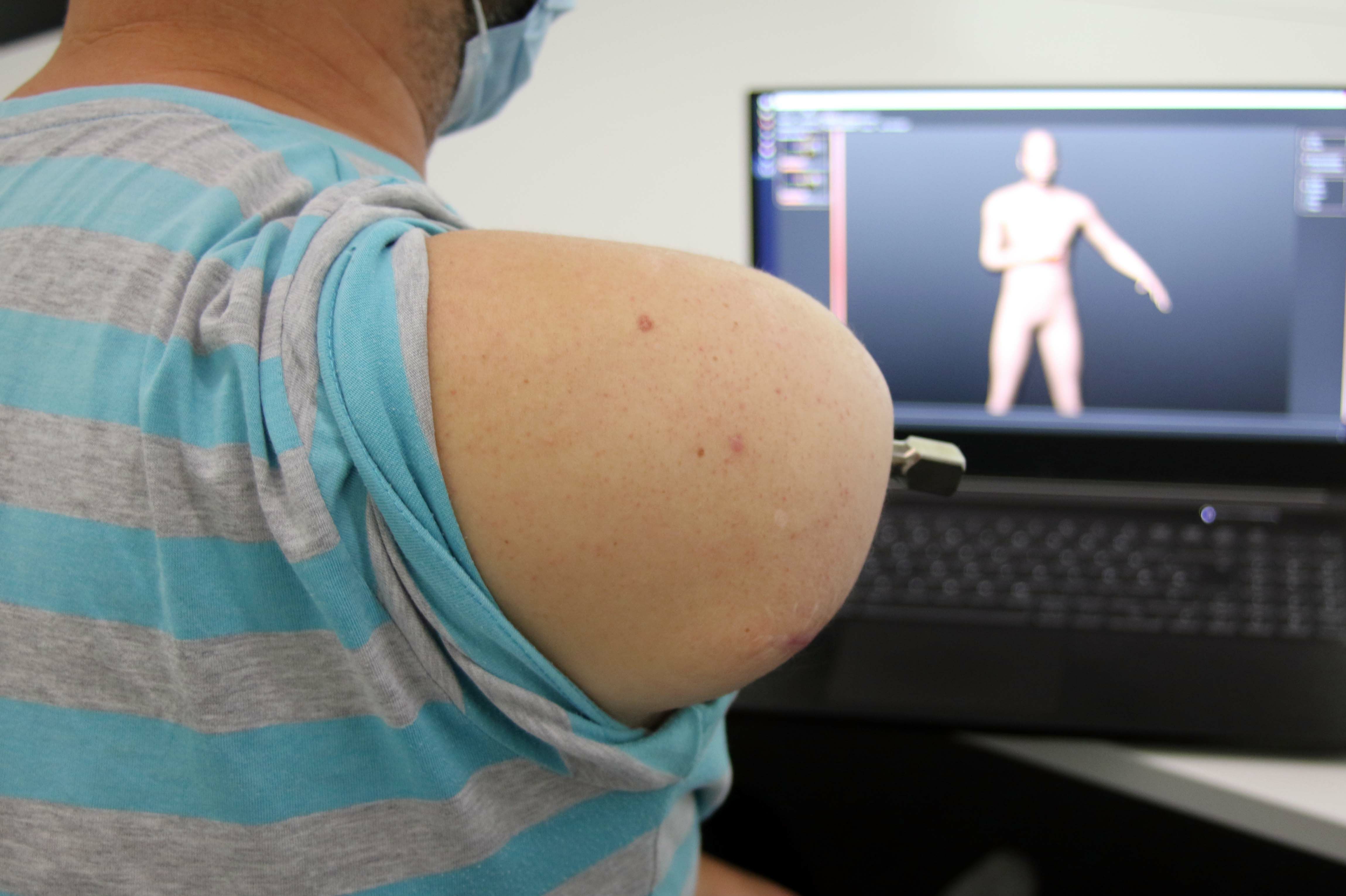 Computer Assisted Limb Assessment (C.A.L.A.) Computer Assisted Limb Assessment (C.A.L.A.)